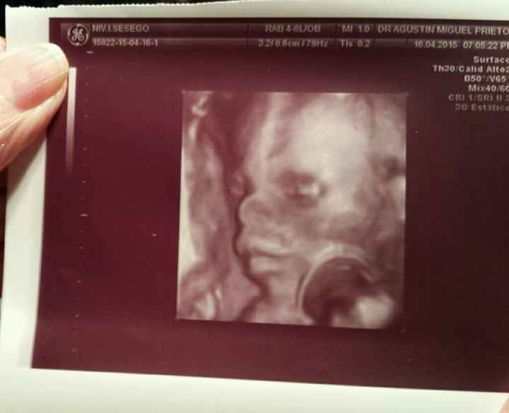 Buscadoras después de uno o varios abortos  - 1