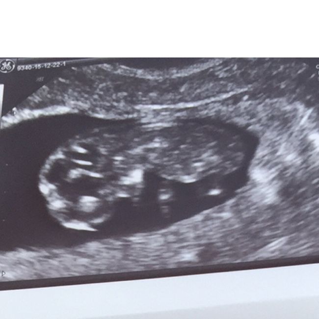 Futuras mamas julio 2016 - 1