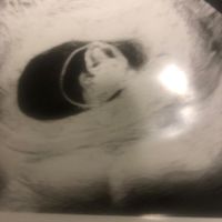Ayuda con método ramzi: niño o niña? - 1