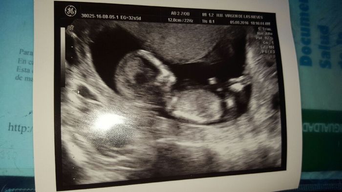 Futuras mamas febrero 2017 - 1