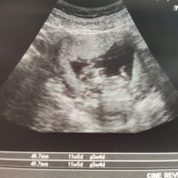 Futuras mamis Enero 2022 - 1