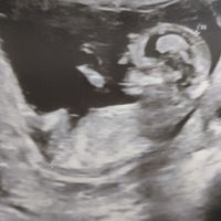 Futuras mamis Enero 2022 - 1