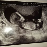 Futuras mamas febrero 2017 - 1