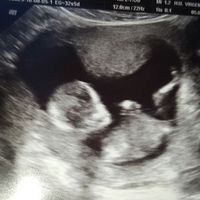 Futuras mamas febrero 2017 - 2