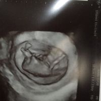 Futuras mamás agosto 2019 - 1