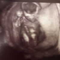 Futuras mamás agosto 2018 - 1