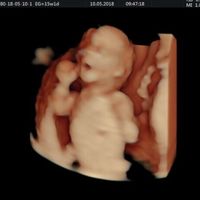 Futuras mamás Octubre 2018!!! - 1