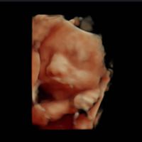 Futuras mamás marzo 2019 - 1