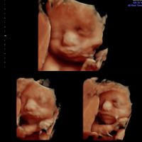 Futuras mamás marzo 2019 - 3