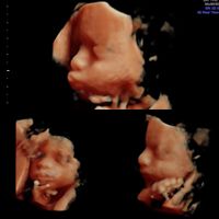 Futuras mamás marzo 2019 - 4