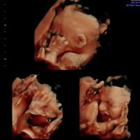 Futuras mamás marzo 2019 - 5