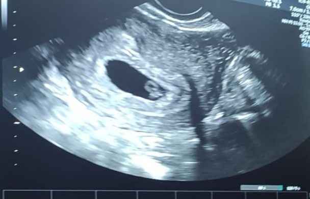 Futuras mamis junio 2021 🤰🏻❤️ oficial - 1
