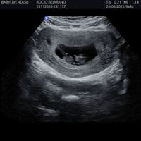 Futuras mamis junio 2021 🤰🏻❤️ oficial - 1