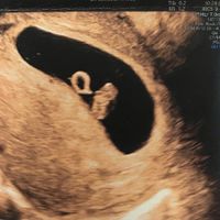 Futuras mamás julio 2021🤰🌹😍😍 - 1