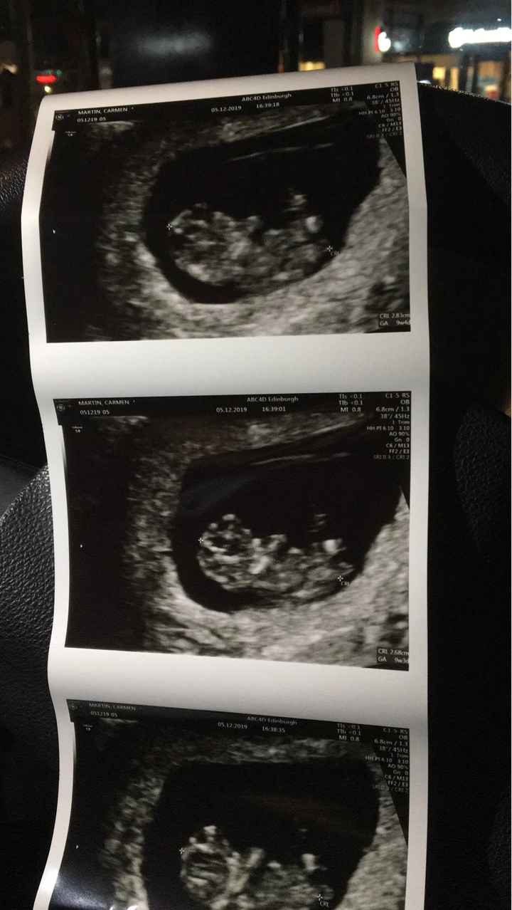 Futuras Mamas Julio 2020. - 1