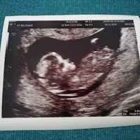 Futuras mamás Junio 2020 - 1