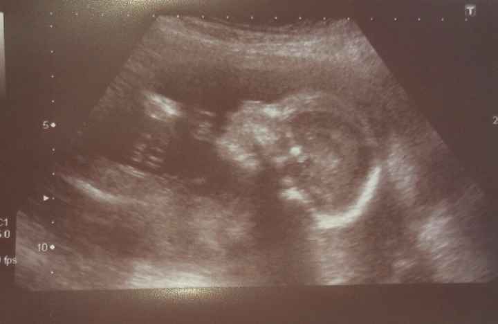 Futuras mamis octubre 2016 - 1