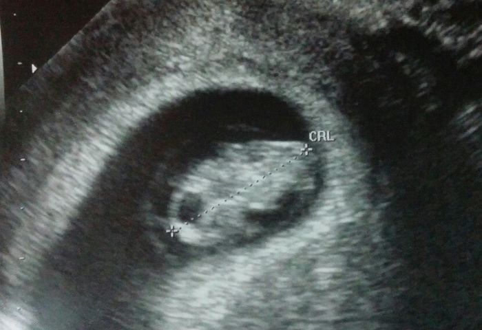 Futuras mamis octubre 2016 - 2