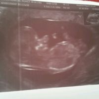 Futuras mamás abril 2017 - 1