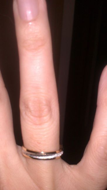 anillo