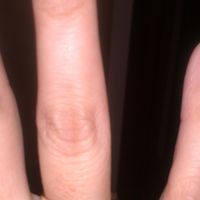anillo