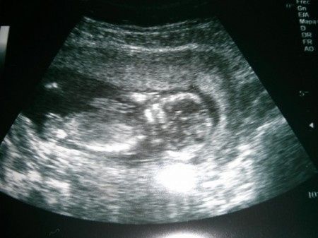 14 semanas
