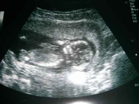 14 semanas