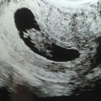 Futuras mamás abril 2017 - 1