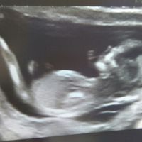Futuras mamás abril 2017 - 1