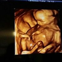 Futuras mamis octubre 2016 - 1