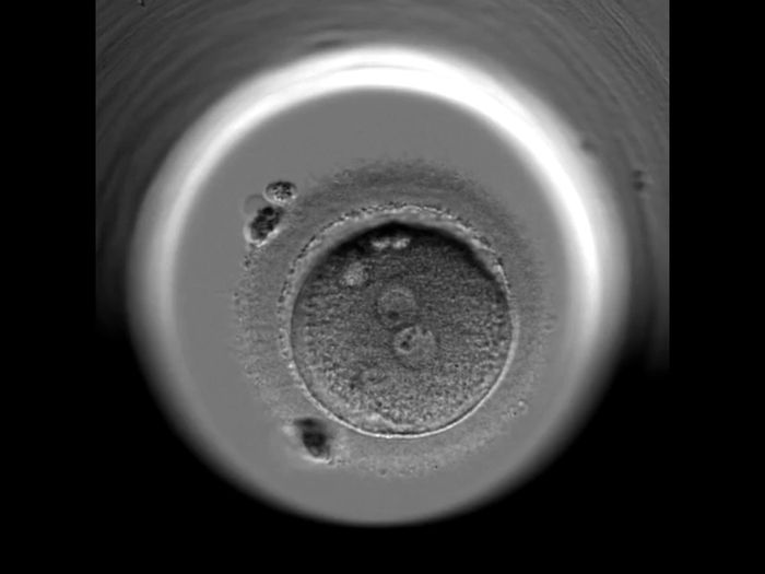 Buscadoras en proceso de pruebas de fertilidad 3