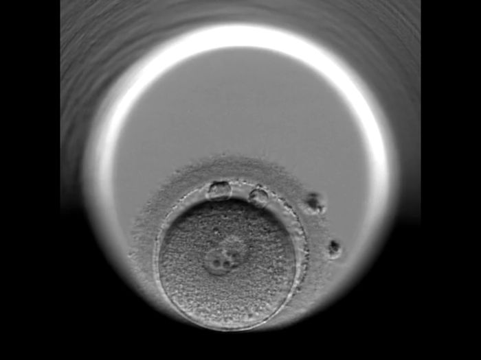 Buscadoras en proceso de pruebas de fertilidad 5