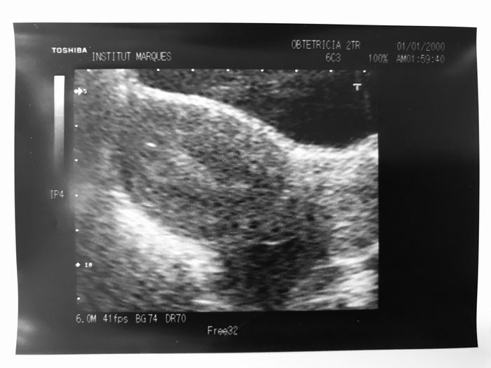 Buscadoras en proceso de pruebas de fertilidad 2
