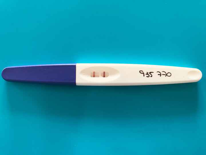 Embarazo y endometriosis - 1