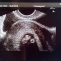 Futuras Mamis Enero 2021 - 1
