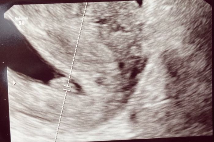 Futuras mamás Octubre 2022 🤰♥️ 1