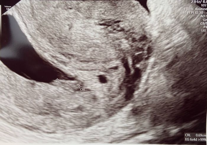 Futuras mamás Octubre 2022 🤰♥️ 2