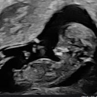 Futuras mamás Octubre 2022 🤰♥️ - 1