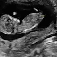 Futuras mamás Octubre 2022 🤰♥️ - 2