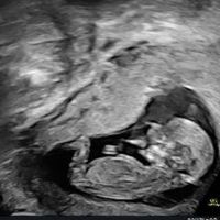 Futuras mamás Octubre 2022 🤰♥️ - 3