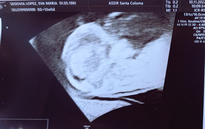 Futuras mamis mayo 2023 2