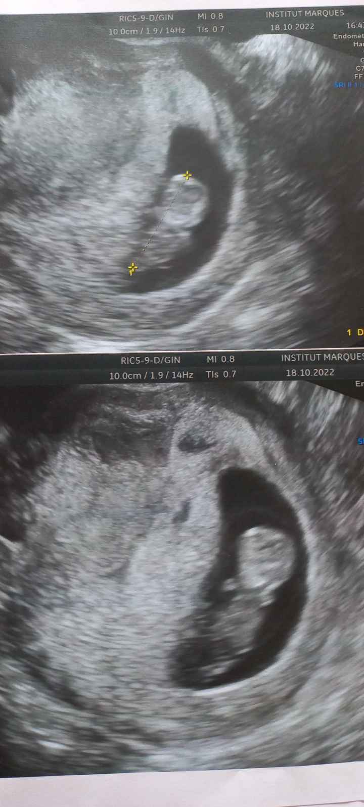 Futuras mamis mayo 2023 - 1