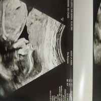 Futuras mamas noviembre 2020 - 2