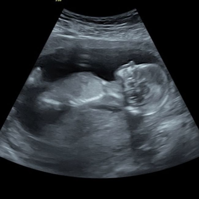 Futuras mamis Junio 2022!! 4