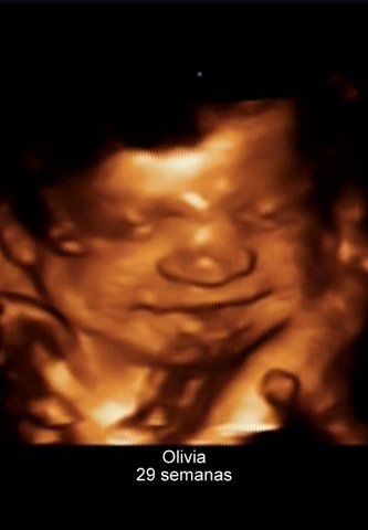 Olivia 29 semanas