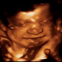 Olivia 29 semanas