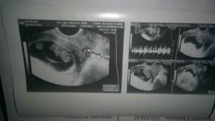Hola chicas tengo 8+5 y fue transvaginal sus actividad cardíaca es de 180 soy primeriza no conozco m