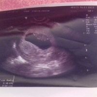 Futuras mamis diciembre 2019 oficial - 1