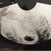 Metodo saad ramzi para saber el sexo del bebe - 1