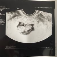 Ayuda con método ramzi: niño o niña? - 1